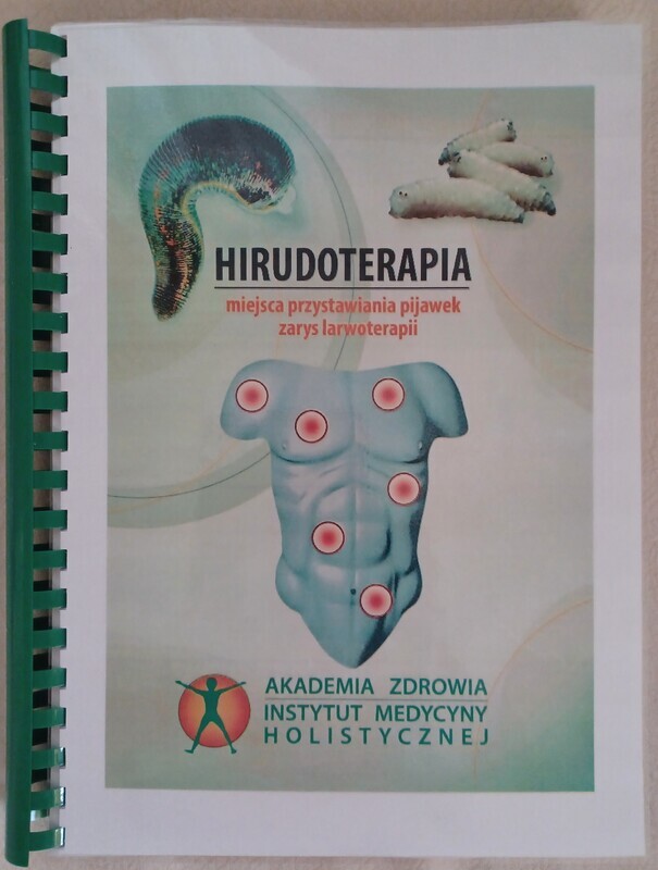 HIRUDOTERAPIA miejsca przystawiania pijawek, zarys larwoterapii