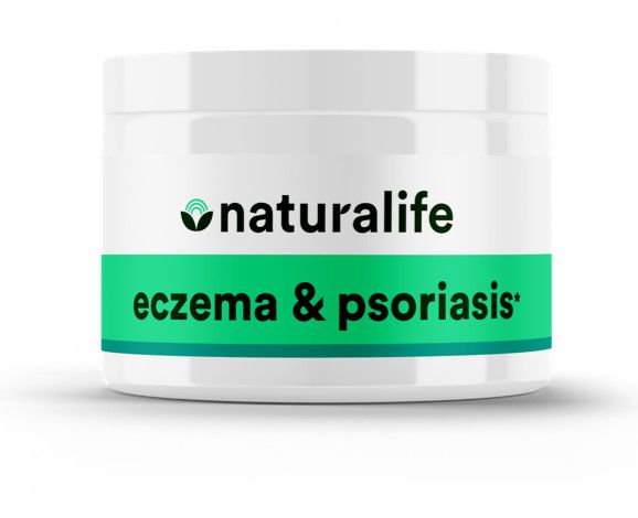NaturaLife, Eczema &amp; Psoriasis Cream, Relieves Itching &amp; Flaking - Aprox 3/4 oz.