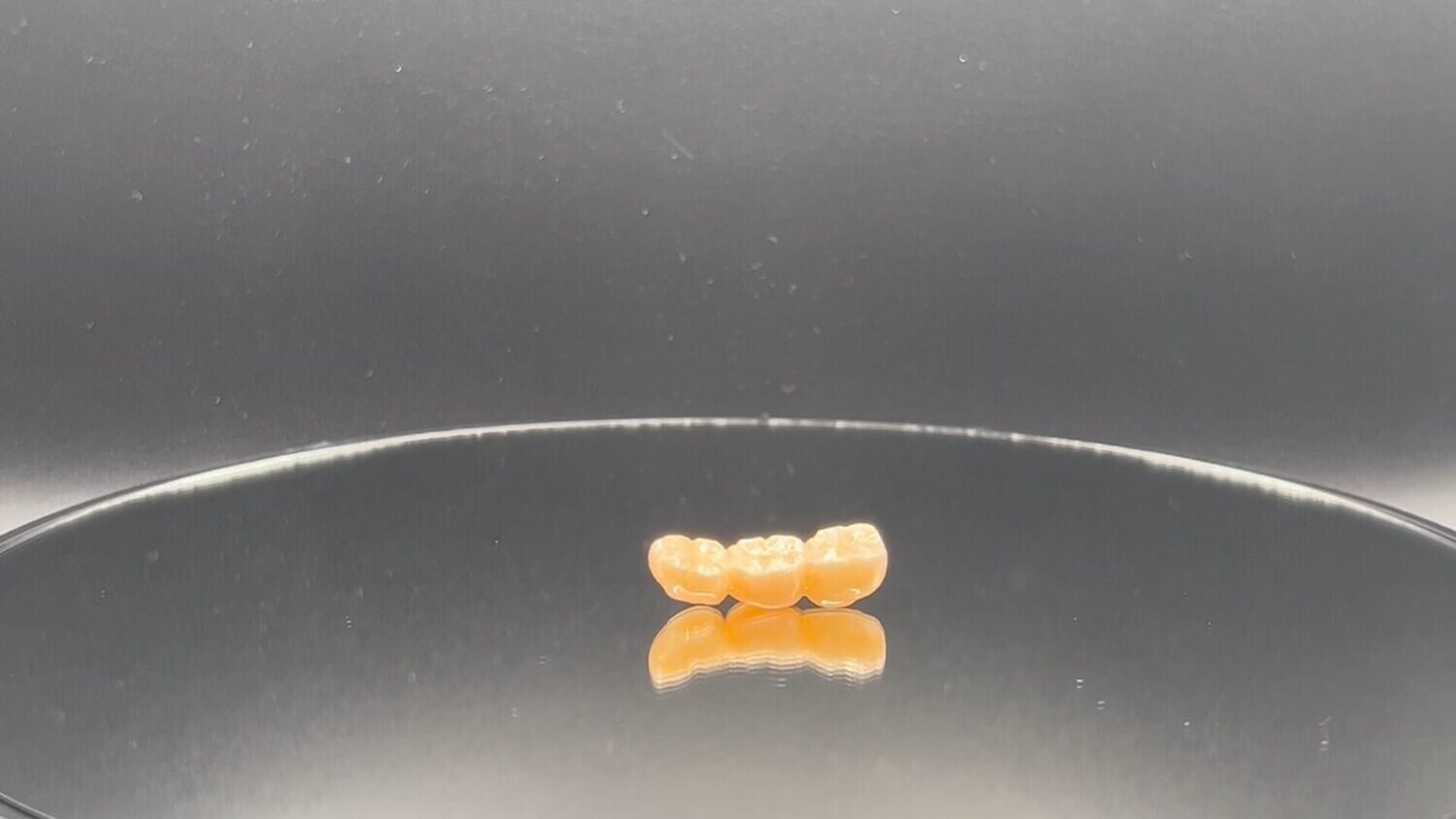 Zirconia Bridge on Prepped Teeth