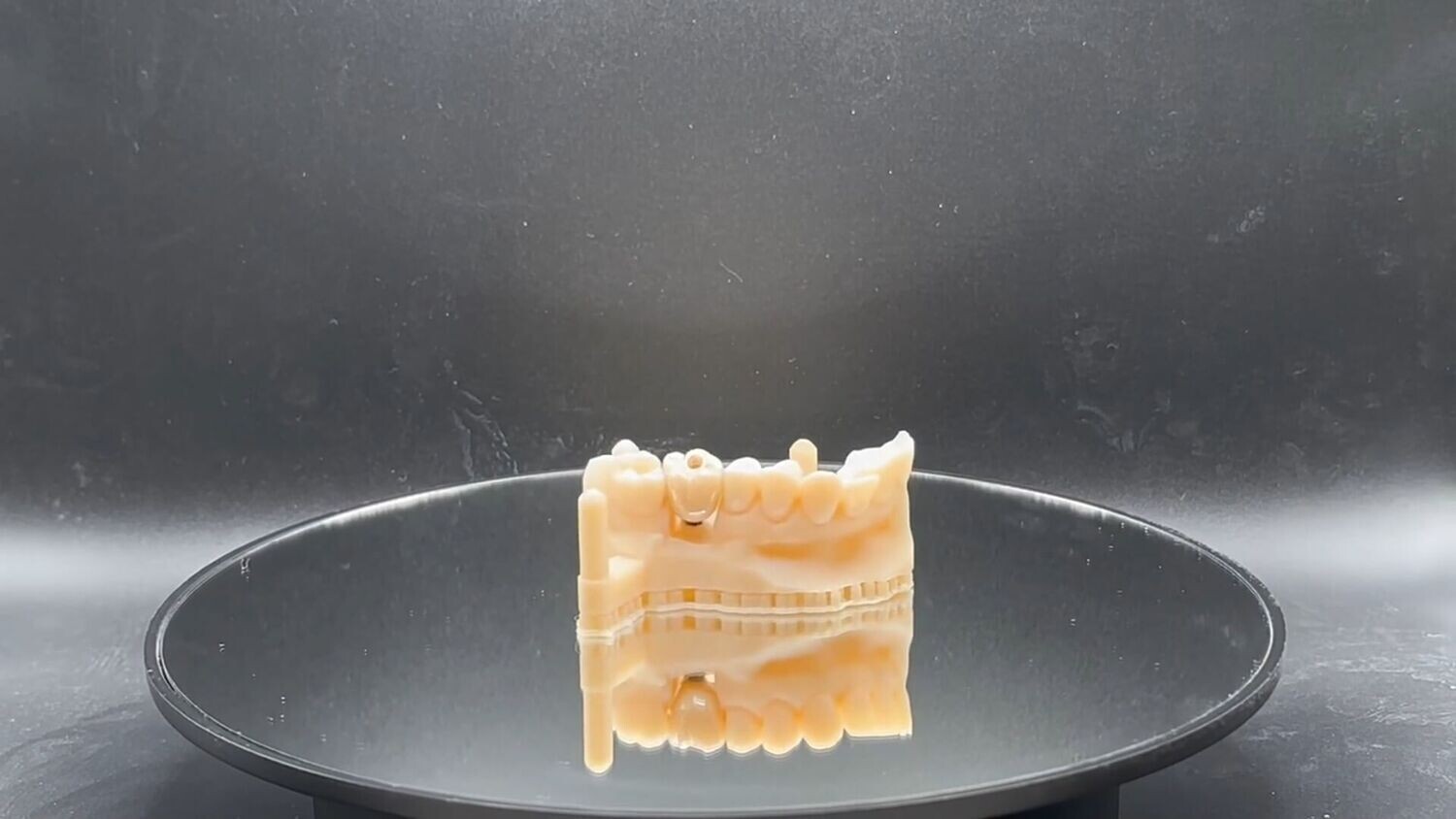 Zirconia Crown on Titanium Abutments