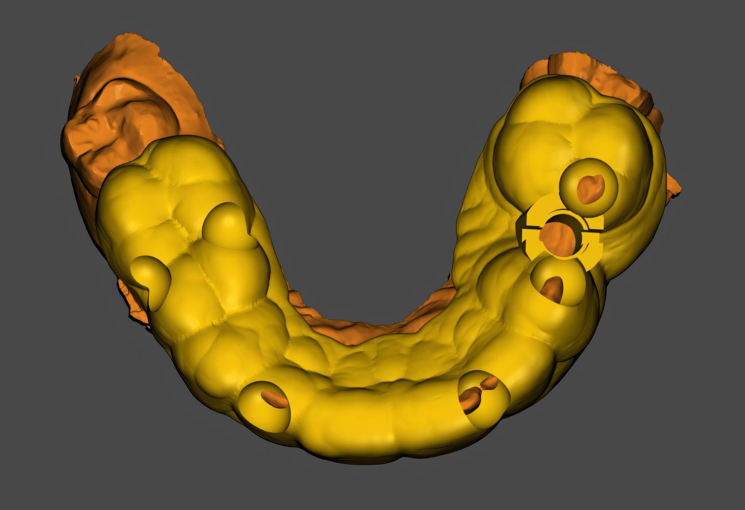 Surgical Guide Design Only