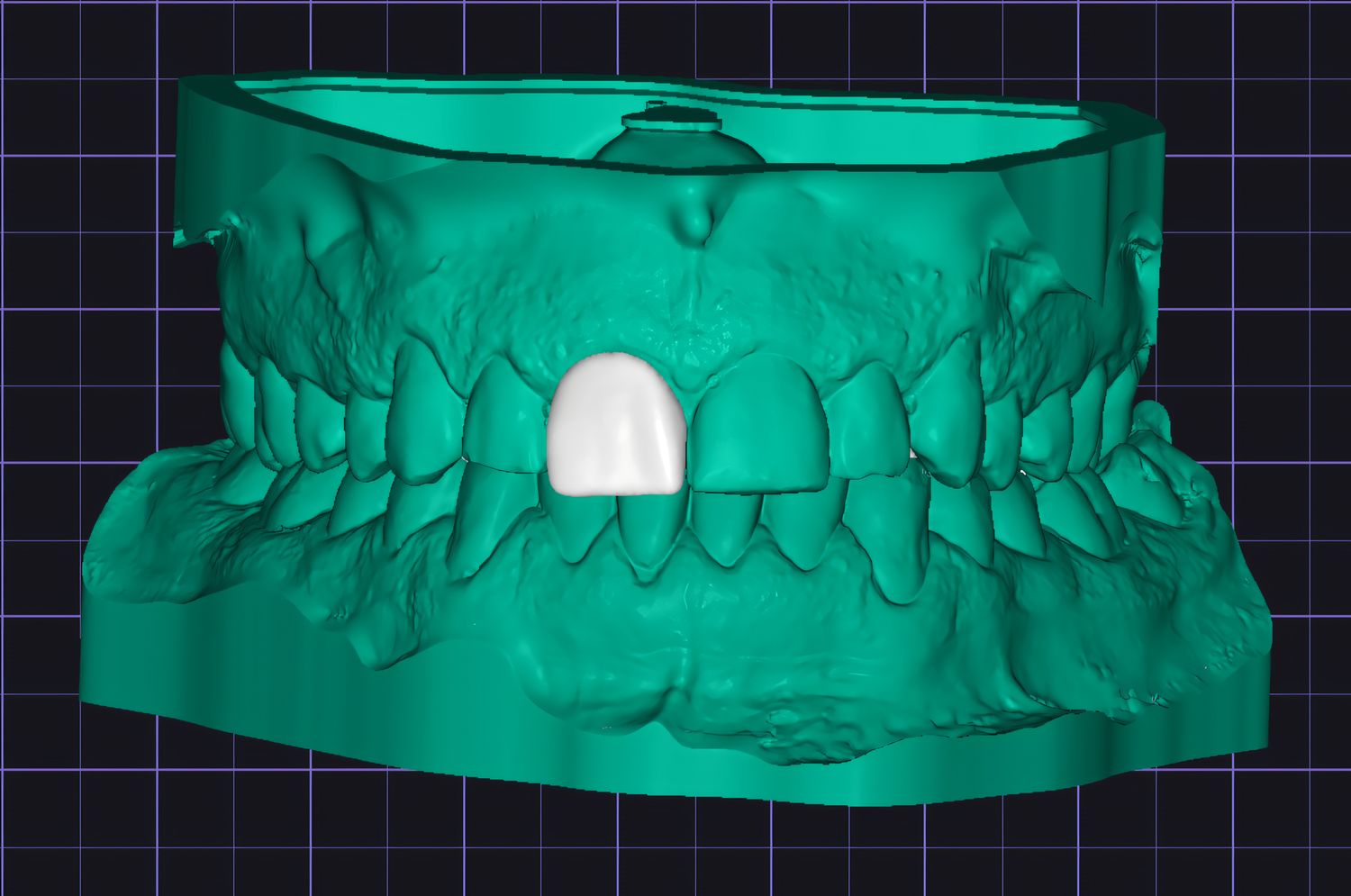 Veneer / Crown Printed Inhouse