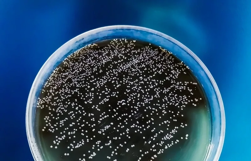 fungal acne: what is it?