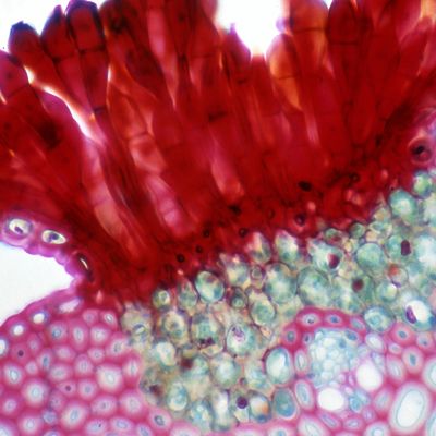 fungal acne: what is it?