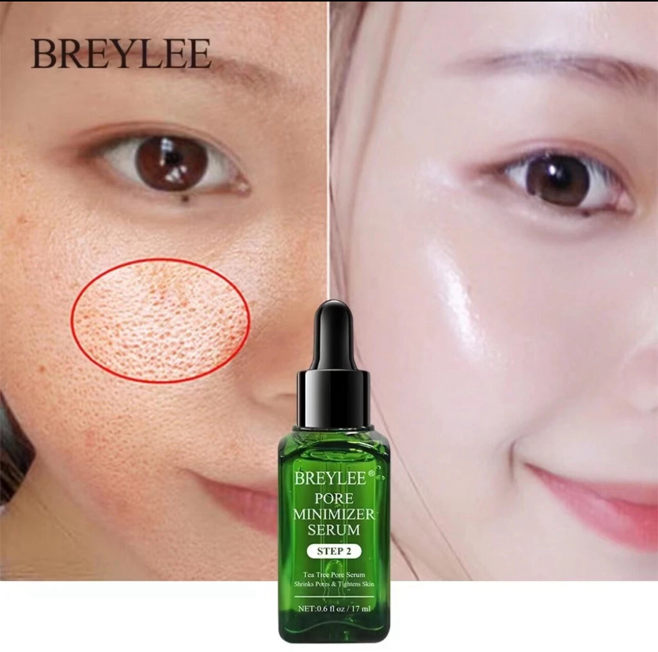 ￼[MALAYSIA READY STOCK] The Beauty Street BREYLEE Blackhead Mask Removal Shrink Pore Cleanses Face Serum 17ml 祛黑头毛孔收缩 3bottle