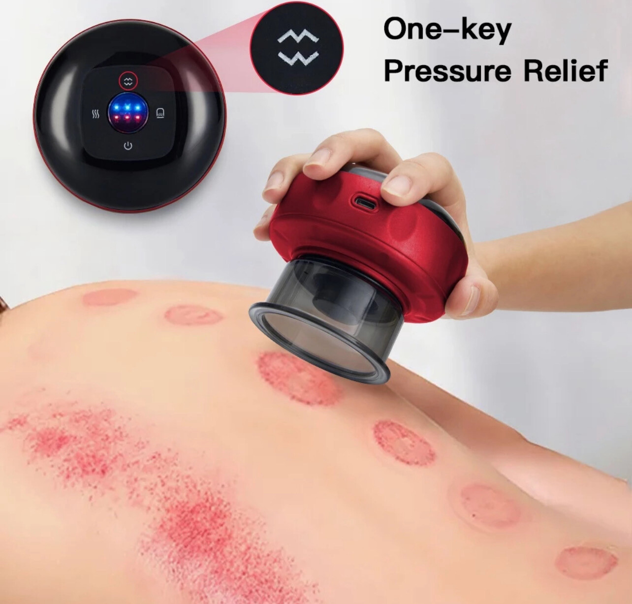 Electric Cupping Massager Electric cupping device Vacuum Suction Cups EMS Ventosas Cellulite Magnet Therapy Guasha Scrap (Bakam Electric)