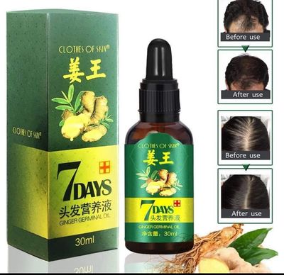 30ML Treatment Ginger Loss Growth Oil Thicker Healthier Hair Care姜王头发营养液  30ML 3bottle