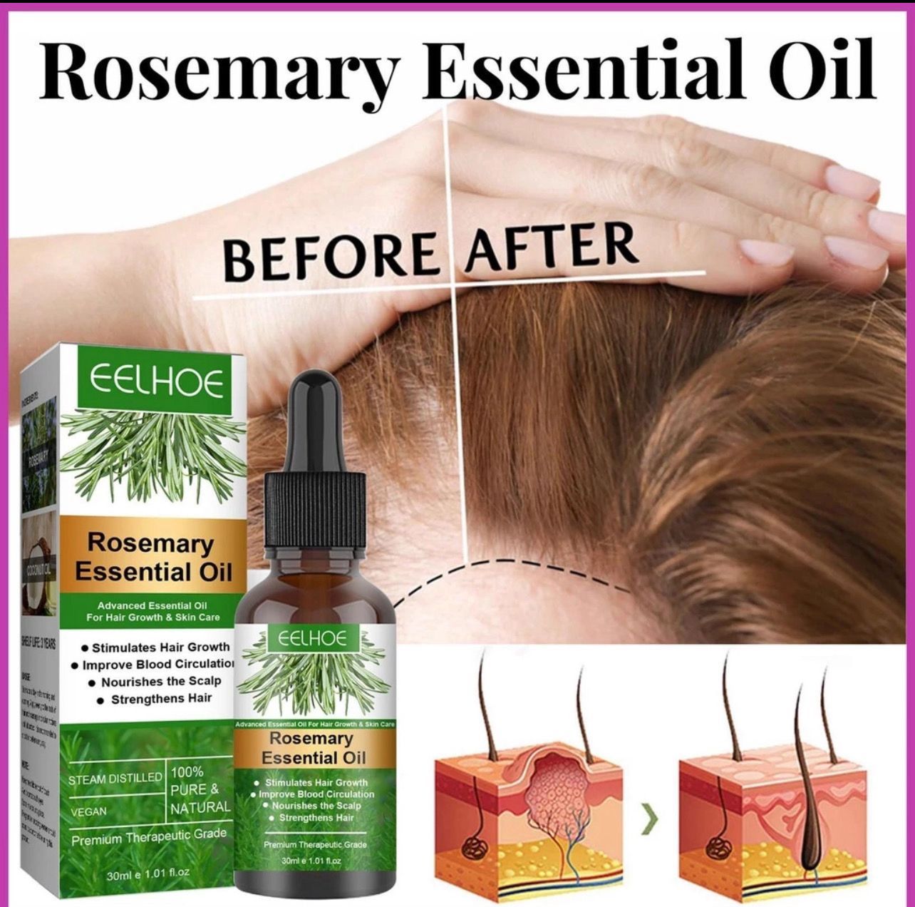 ￼Hair Growth Oil 30ml Rosemary Oil for Hair Growth Natural Rosemary Oil Hair Serum for Hair Loss Treatment Hair 3bottle