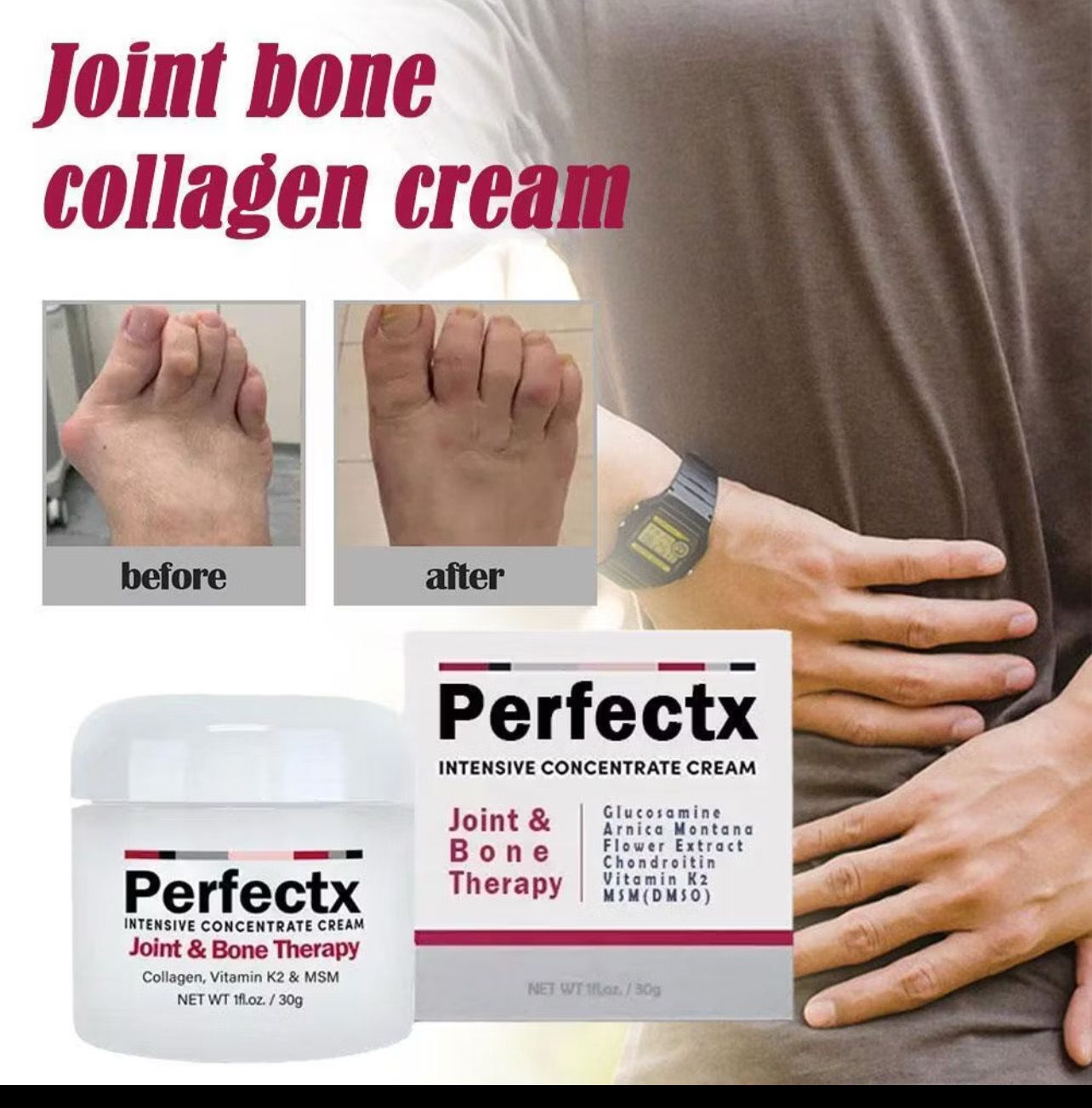 ￼Perfectx Collagen Cream Joint Bone Pain Relieve Correct Bone Deformation Correction Repair Cream Treatment Cream perfect 3pcs