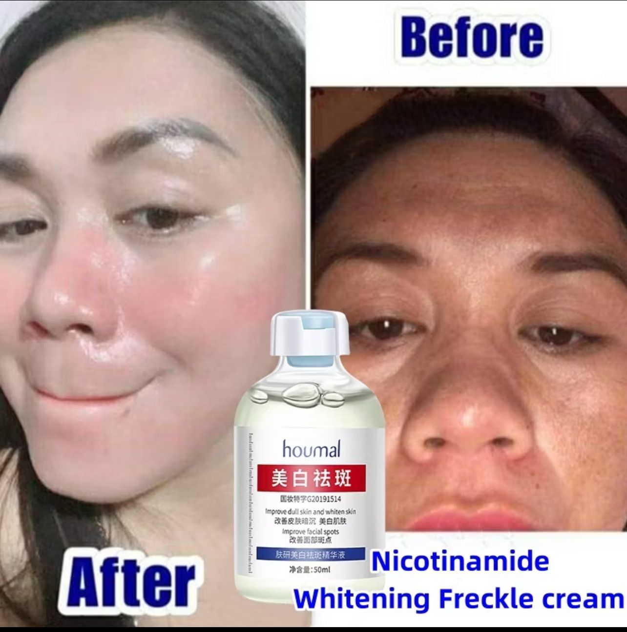 Nicotinamide Whitening Freckle Serum dark spot remover krim jeragat pigmentation treatment brighten melanon skincare