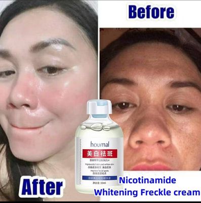 Nicotinamide Whitening Freckle Serum dark spot remover krim jeragat pigmentation treatment brighten melanon skincare