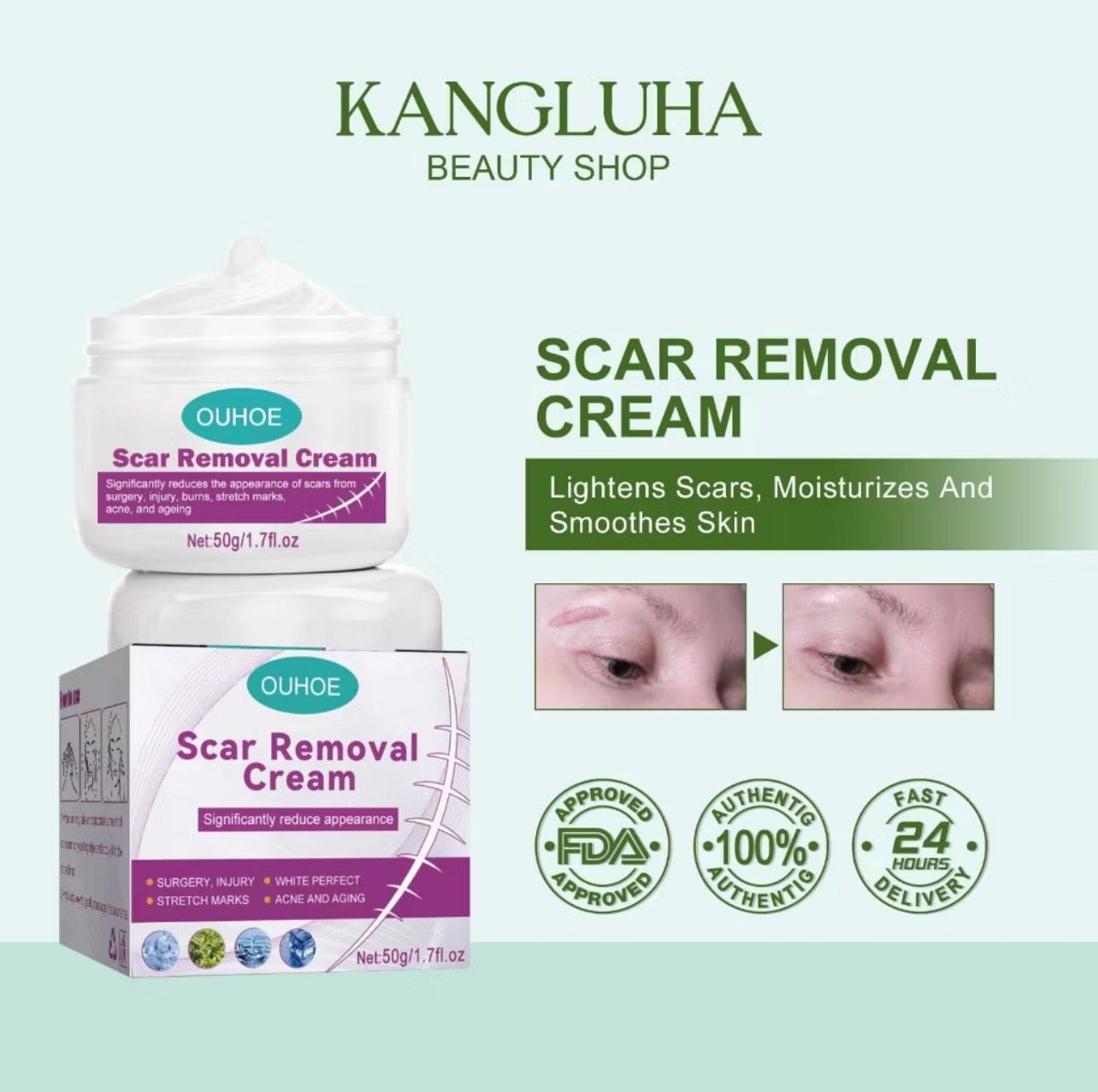 OUHOE Scar Removal Cream 50g Repair Scars Operation Scald Cream Old Scars Acne Scars Treatment 2pcs $10.00