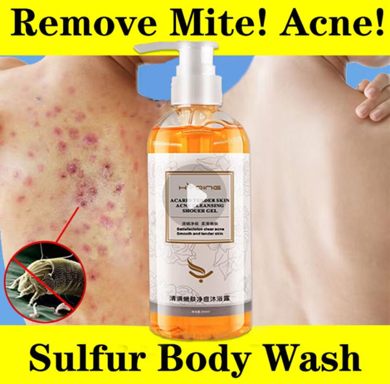 2bottle $10.00 - Shower Body Wash Mite Removal Acne Lasting Fragrance 260ml Unisex Body Wash Mite Removal Acne Lasting Fragrance, Cleaning Hydrating Whitening Remove Mites Shrink Pores Control Oil