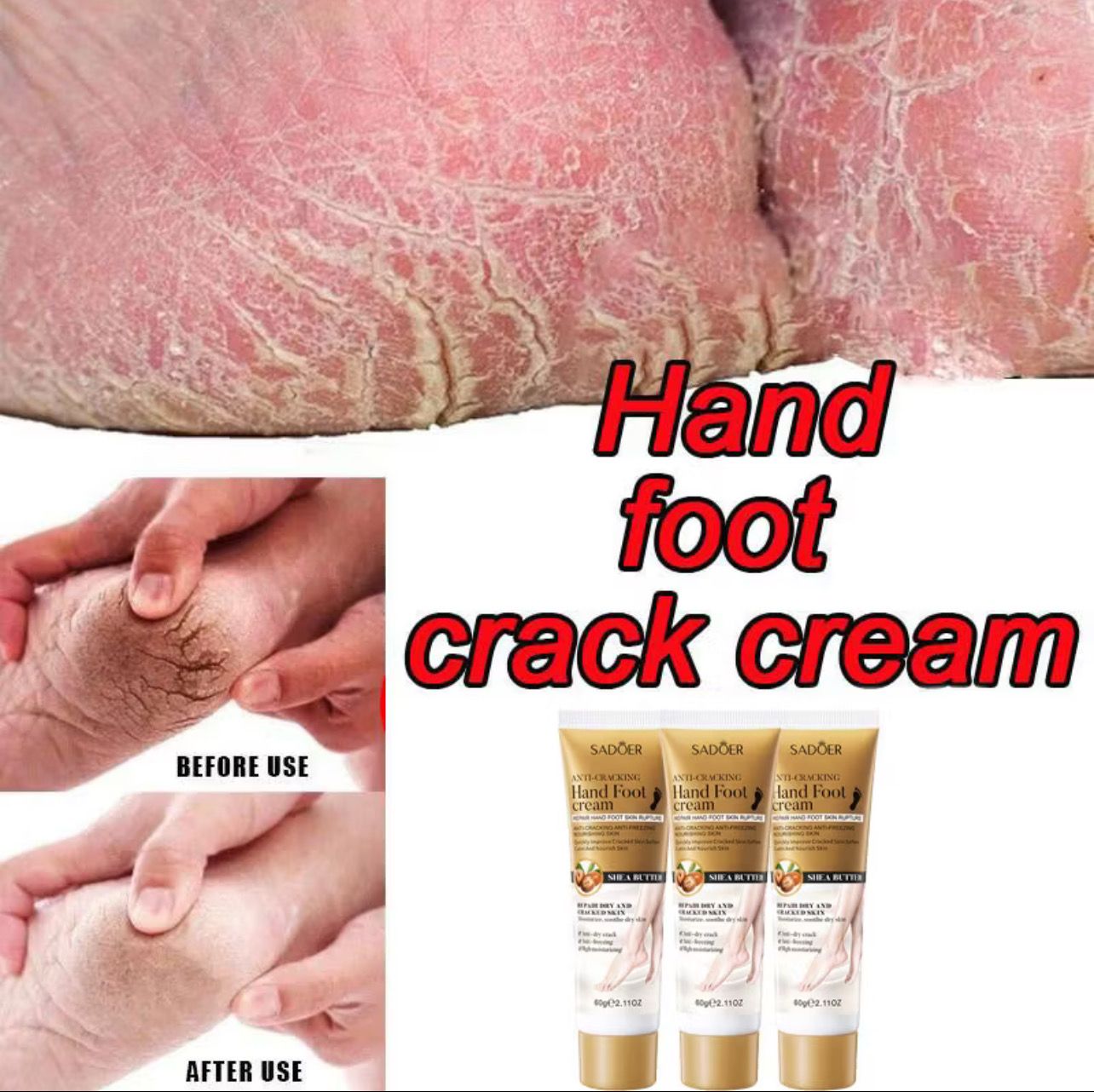 3pcs $10.00 防干裂手足霜 Moisturizing Hand Cream Anti Wrinkle Hand and Foot Cream Foot Care 60g Long lasting Moisturizing Mild Non irritating Safe and Efficient Krim tangan dan kaki anti retak