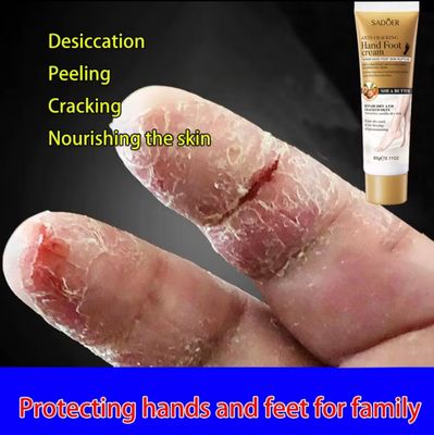 3pcs $10.00 防干裂手足霜 Moisturizing Hand Cream Anti Wrinkle Hand and Foot Cream Foot Care 60g Long lasting Moisturizing Mild Non irritating Safe and Efficient Krim tangan dan kaki anti retak