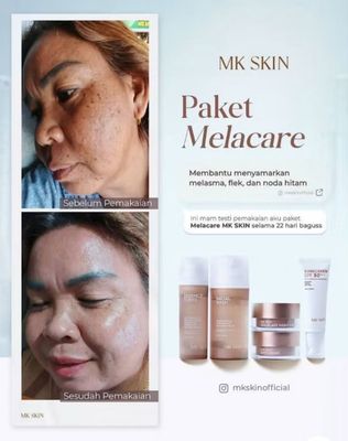PROMO $39.00 Mk skin paket mk skincare original