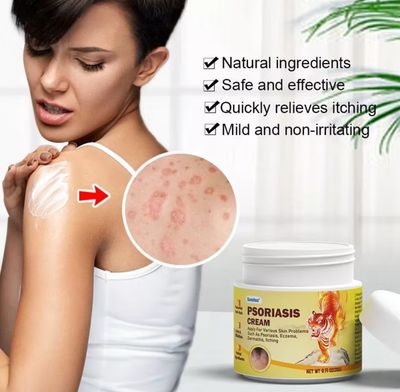 4bottle $10.00【READY STOCK】 20g  Psoriasis Cream Antifungal cream Eczema cream Cream gatal kulit krim gatal kulit herba cina Ubat gatal herba cina  止痒膏
