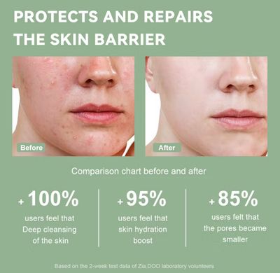 2bottle $10.00 ￼ZIA.DOO Oil Cleansing Mousse Australian Tea Tree Amino Acid Gentle Cleanser Control Anti-Acne Deep Cleans Pores Face Wash Foam Cleanser（100ml）Cleanser For Sensitive Skin Facial Wash