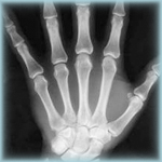 Bone Health