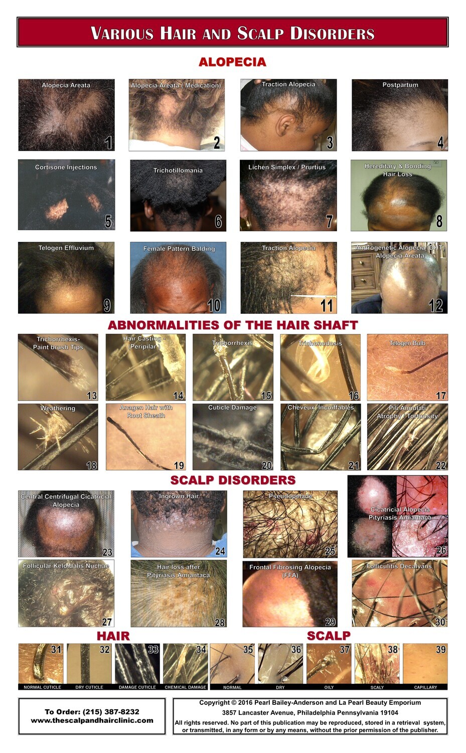 50% Discount - 4 Hair &amp; Scalp Posters for your, Salon, Clinic or Practice. Sale Ends November 30th, 2023