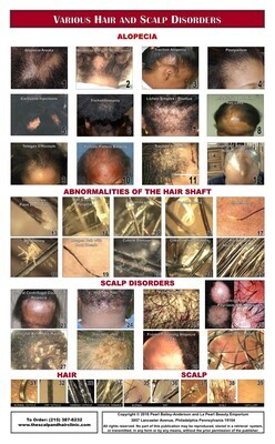 50% Discount - 4 Hair &amp; Scalp Posters for your, Salon, Clinic or Practice. Sale Ends November 30th, 2023