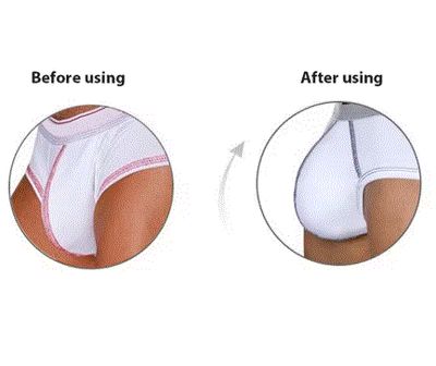 Bulge Pad