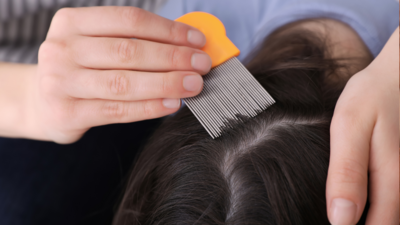 Lice Removal Treatment