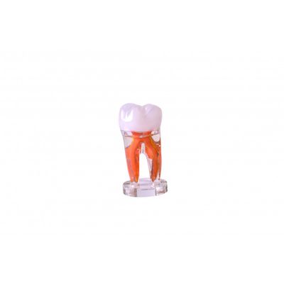 Model dinte endodontic
