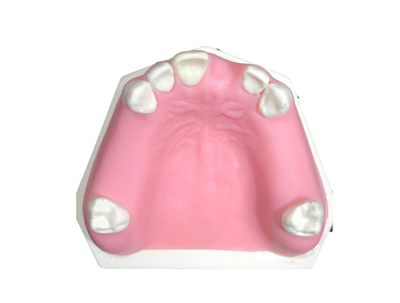 STM | Modele Chirurgicale Dentare IMP302C