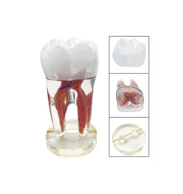 Model dinte endodontic