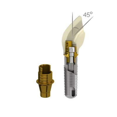Dynamic Abutment