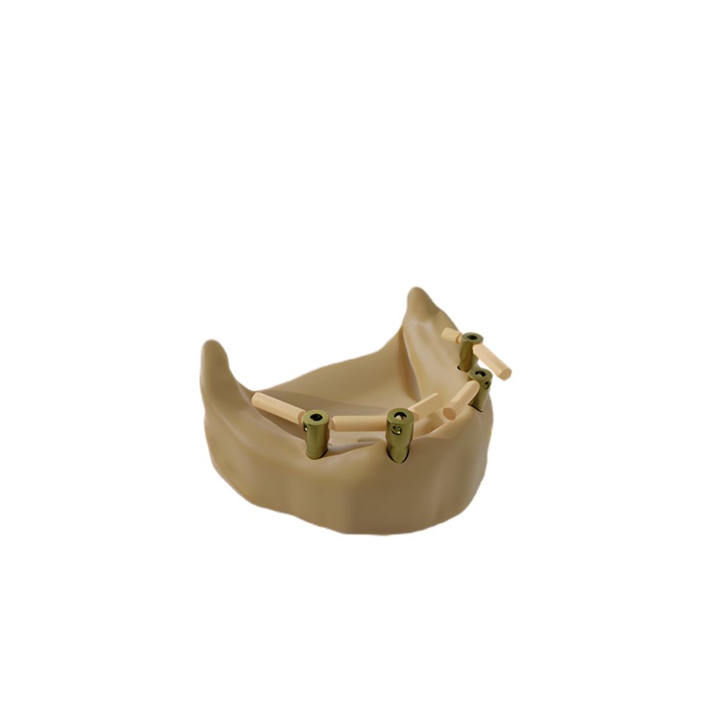 Pini de scanare Scanbody B - 9 mm