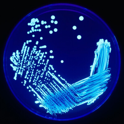 Legionella Water Testing