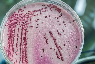 Legionella
