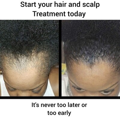 GROW IT HAIR OIL