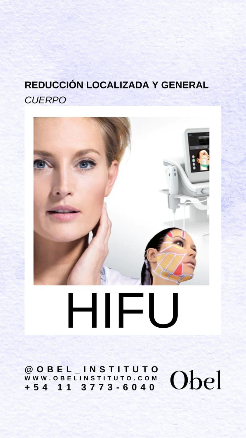 HIFU CUERPO Reducción localizada y general