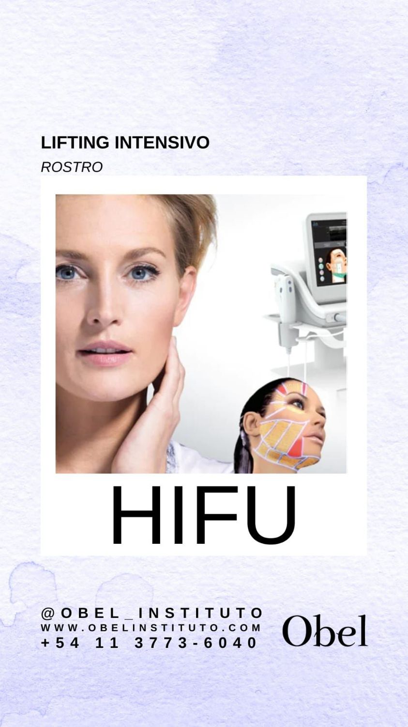 HIFU LIFTING INTENSIVO ROSTRO