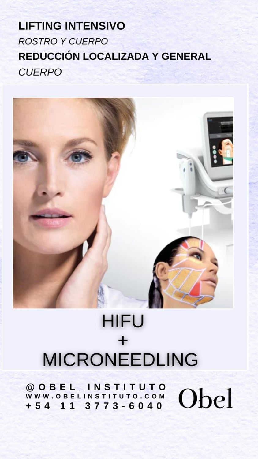 Pack 4 sesiones HIFU SÚPER -  Rejuvenecimiento facial o Reductor Corporal