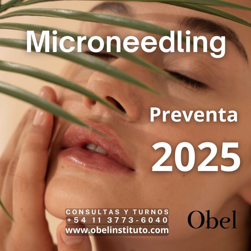 MICRONEEDLING preventa - SÚPER PROMO - CUPOS LIMITADO MICRONEEDLING preventa - SÚPER PROMO - CUPOS LIMITADO