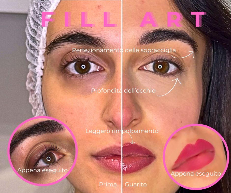 MASTER FILL Art