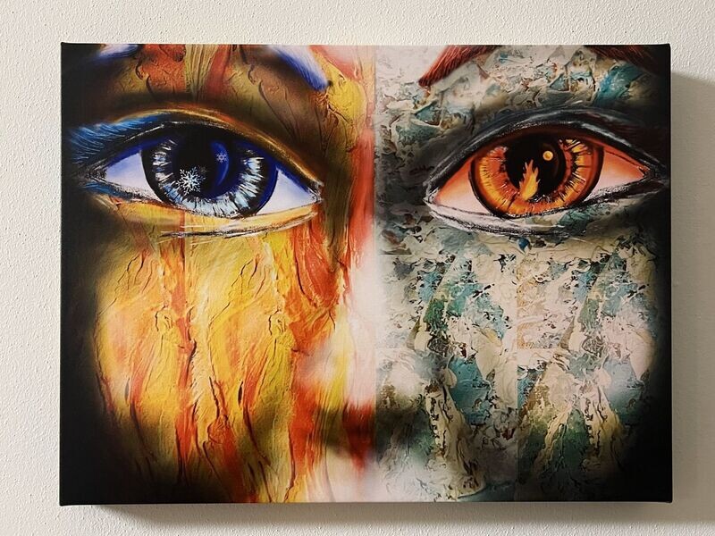 Heterochromia
