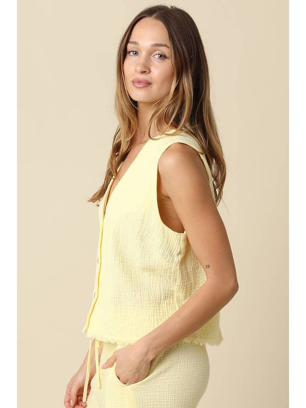 Camille Button Front - Yellow
