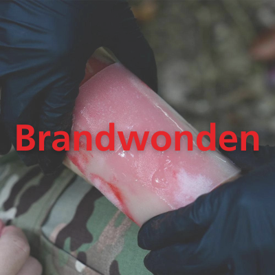 Brandwonden