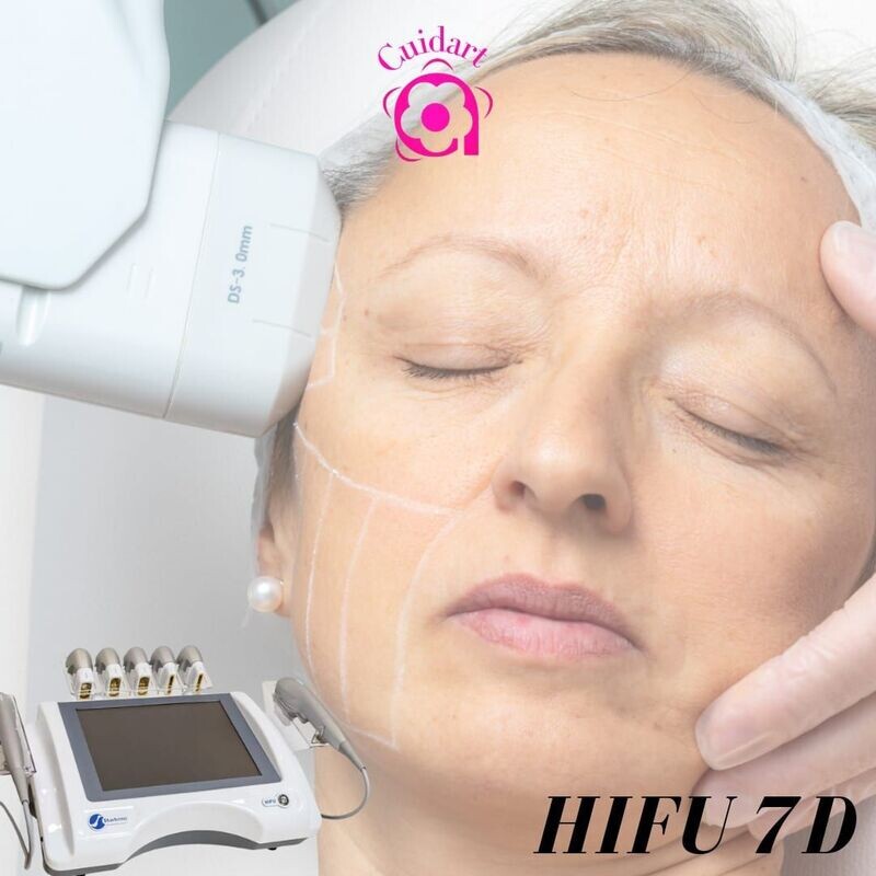 HIFU  7D