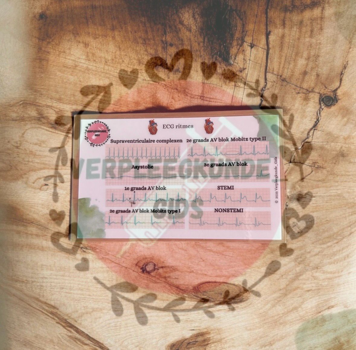 ECG Ritmes KAART 2
