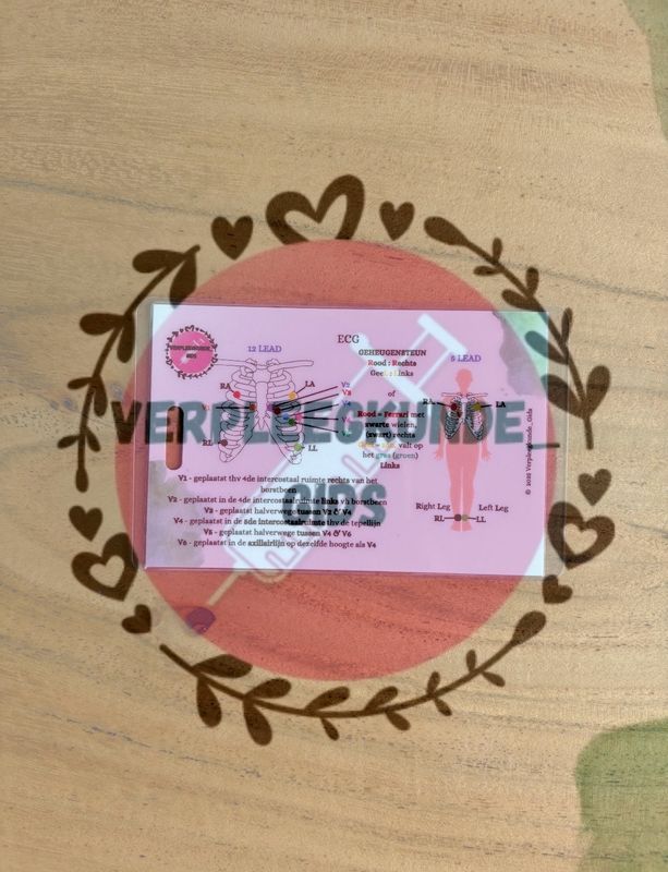 ECG/ Aandachtspunten