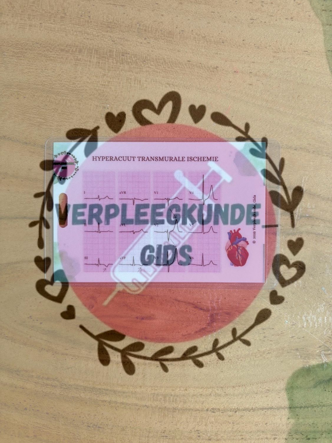 Acuut transmurale ischemie/ Transmurale ischemie