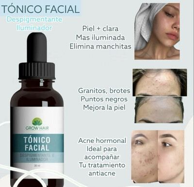 TÓNICO FACIAL