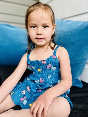 Blue Meow Dress