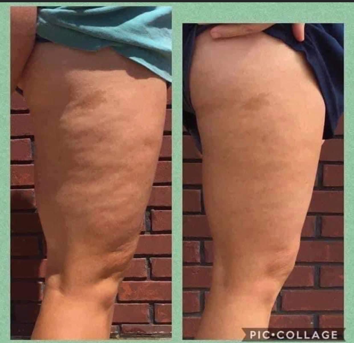 Dermatic Effects Firming Cream